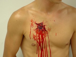 Chest Wound